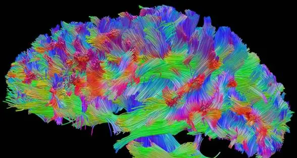 Con la cannella il cervello può diventare più reattivo