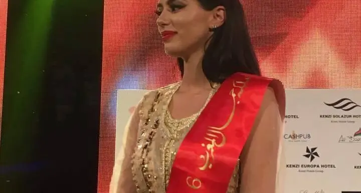 Miss Marocco, bufera per i complimenti del chirurgo plastico