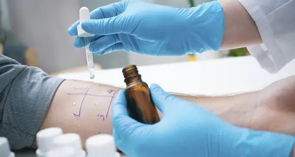 Primo vaccino-farmaco per l'allergia agli acari, entro l'anno in Italia