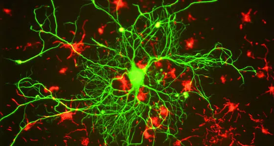 Terapia con le staminali ripara il cuore che non pompa più sangue