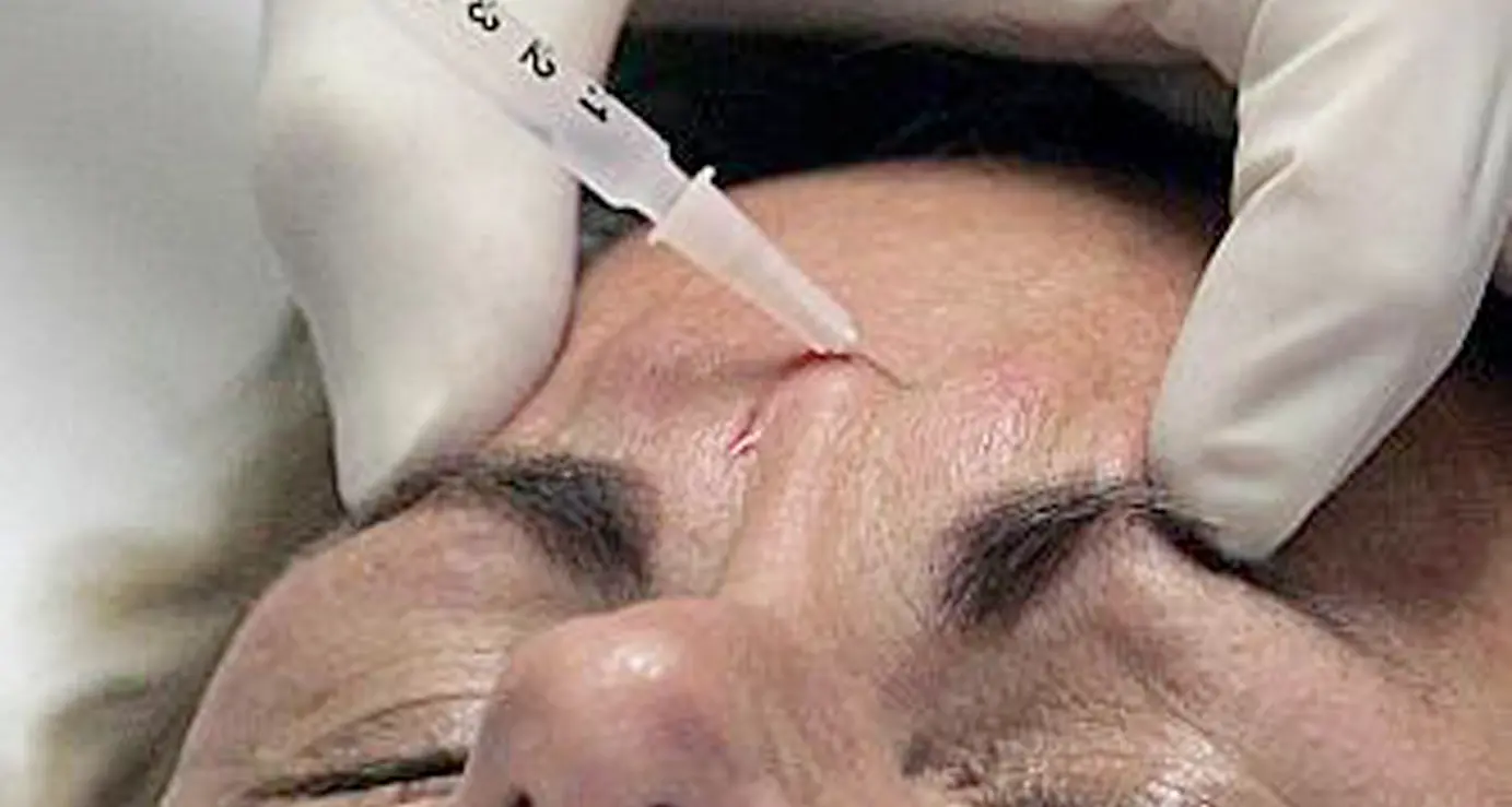 Stop al botox imposto: le star di Hollywood si mobilitano