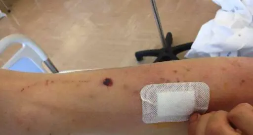 Cembra, operaio pestato in una cava di porfido. Tre imputati: lesioni gravi e sequestro di persona