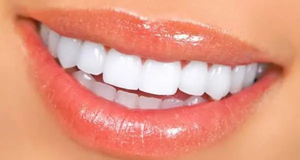Ridere fa dimagrire e non è uno scherzo, si bruciano calorie