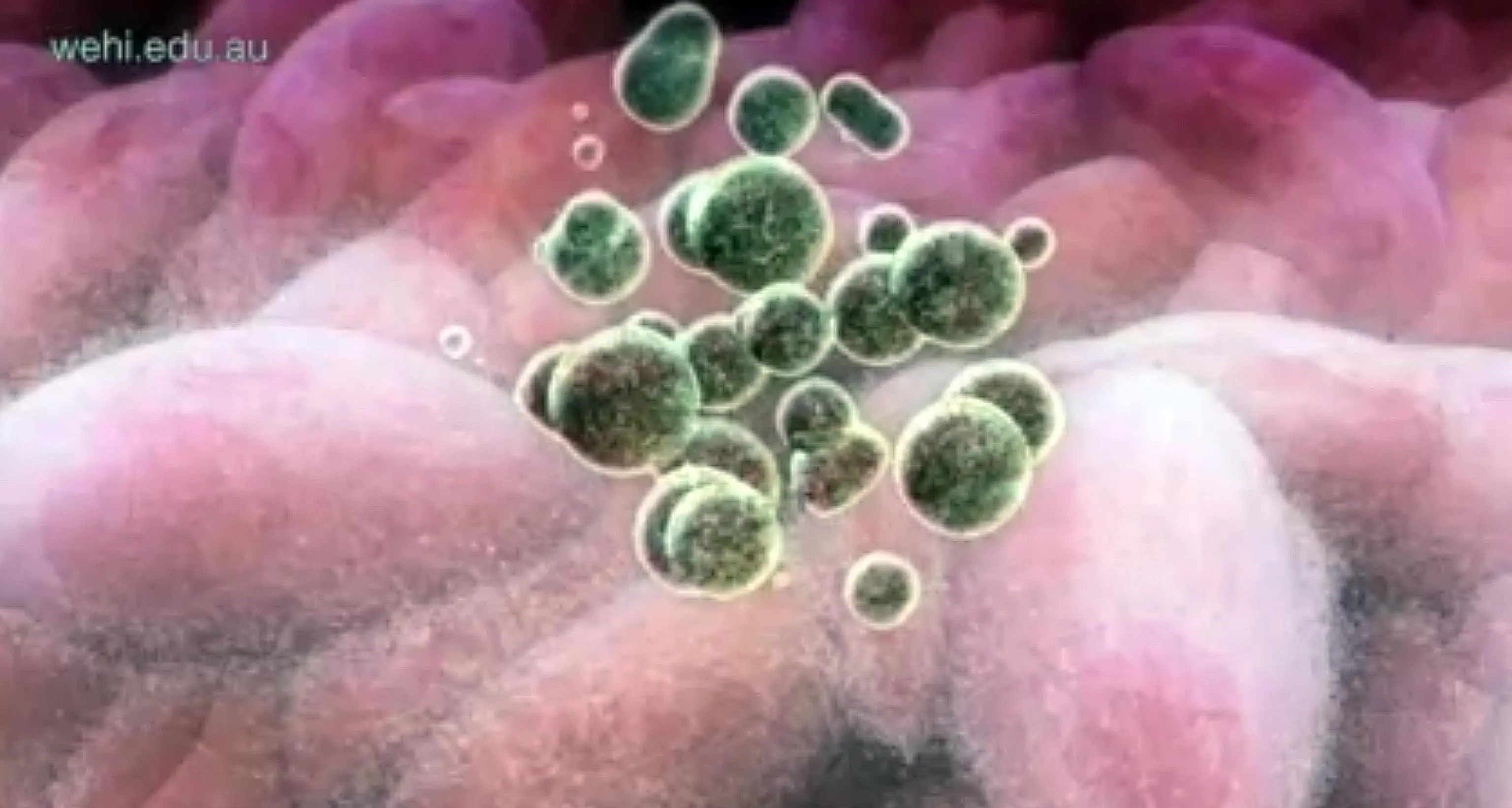 Contro il cancro all'utero arriva l'Hpv test