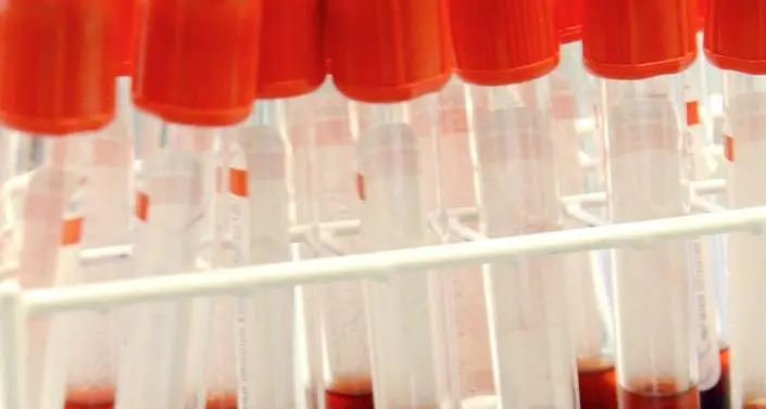 Doping di stato, la Russia contro l'ex direttore dei suoi laboratori