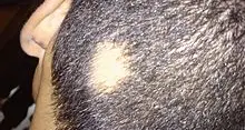 Bimbo perde i capelli, il suo allenatore si rasa