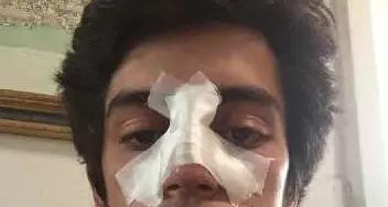 Cerca di andare alla festa, picchiato dalla sicurezza