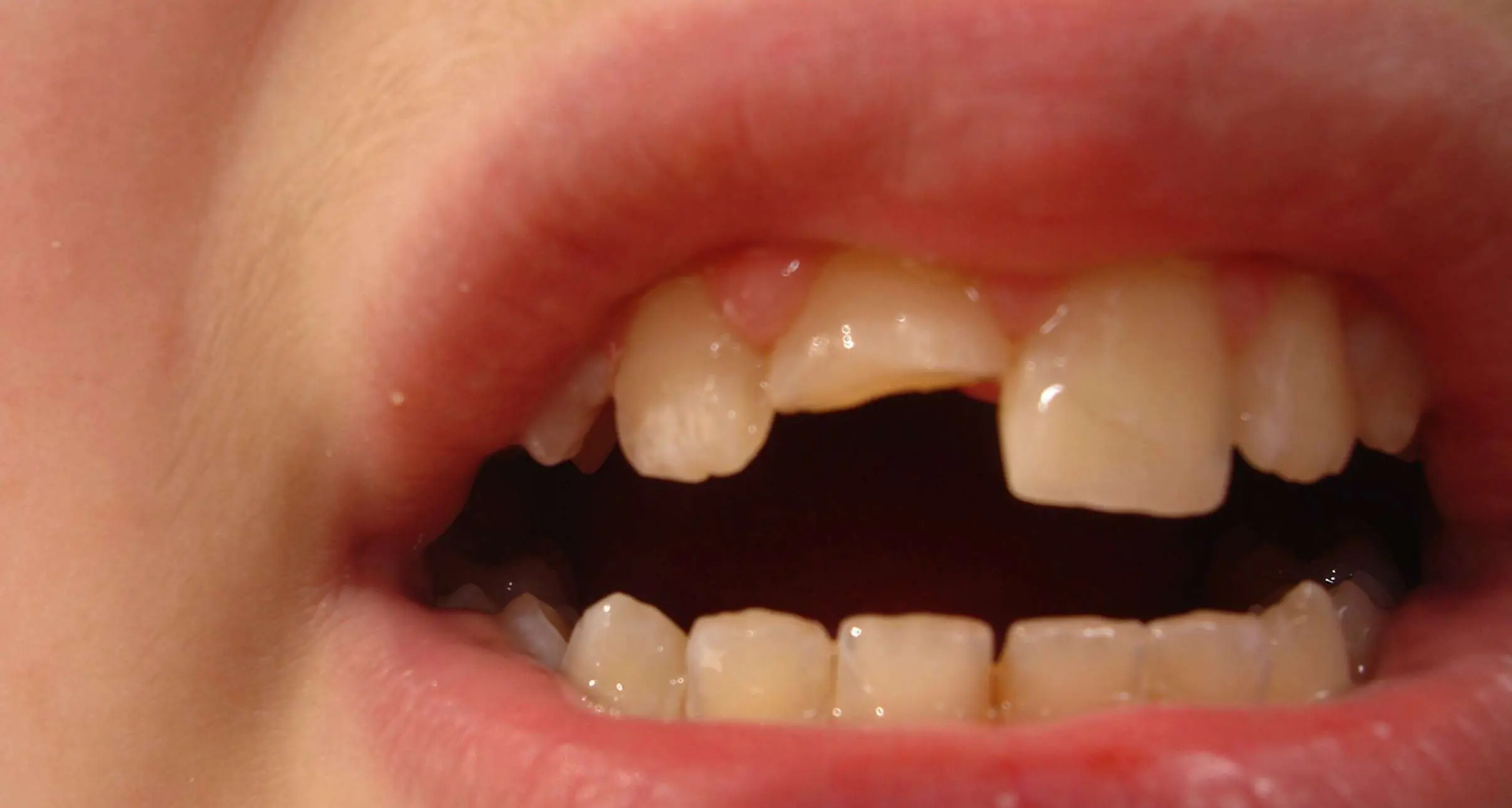 Denti curati a 38 mila persone