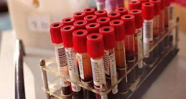 Manca sangue in regioni \"turistiche\", appello ai donatori