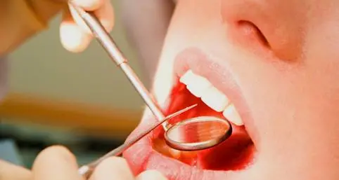 Giornata mondiale della salute dei denti, allarme carie