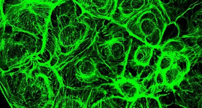 Scoperta la proteina Mical alleata \"silente\" dei tumori: ora la si può combattere