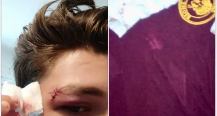 Hanno la maglia rossa del cinema Picchiati dai neofascisti 4 ragazzi
