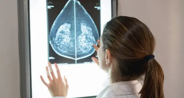 Tumore al seno, 10 mila donne candidabili al test genomico