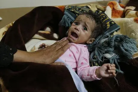 epaselect epa07518261 A woman holds her cholera-infected child as he receives treatment at a cholera treatment center amid a cholera outbreak, in Sana'a, Yemen, 20 April 2019. According to reports, nearly 460 deaths of cholera have been registered in Yemen since the beginning of 2019 while more than 223 thousand suspected cases have been reported so far. Nearly a quarter of the cases of children are under five. EPA/YAHYA ARHAB