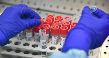Covid, tamponi effettuati da personale non medico: tre denunciati