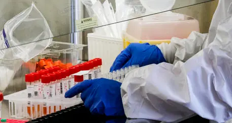 Tamponi positivi ma sospetti, Ruscitti: «Così si gioca con la vita degli altri, l'Apss vigila anche in collaborazione con i Nas»