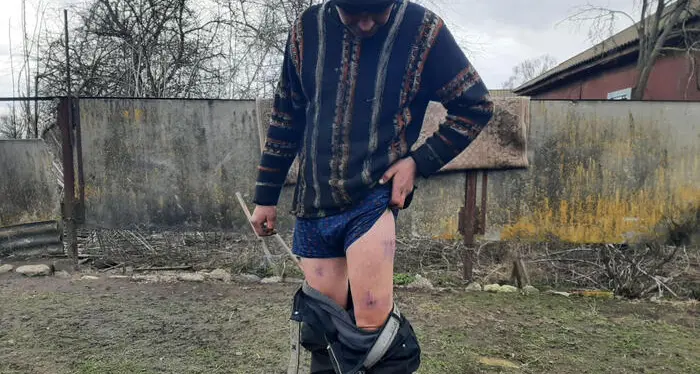 \"Qui a Lukashivka i militari russi mi hanno torturato\"