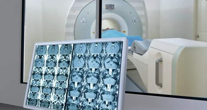 Taglio alle liste d'attesa, più soldi alle strutture private trentine: quasi la metà per servizi di radiologia