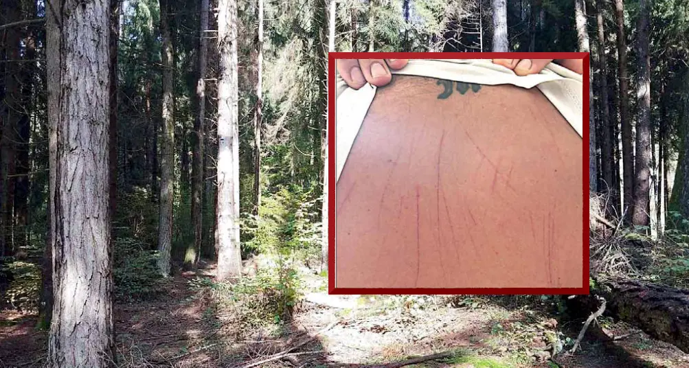 L'uomo colpito dall'orso: «Mi ha spinto e poi mi ha tenuto fermo qualche secondo, non va abbattuto»
