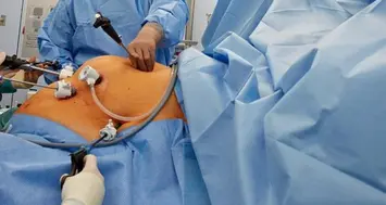 Obesità in crescita in Trentino, 610 interventi chirurgici al Santa Chiara
