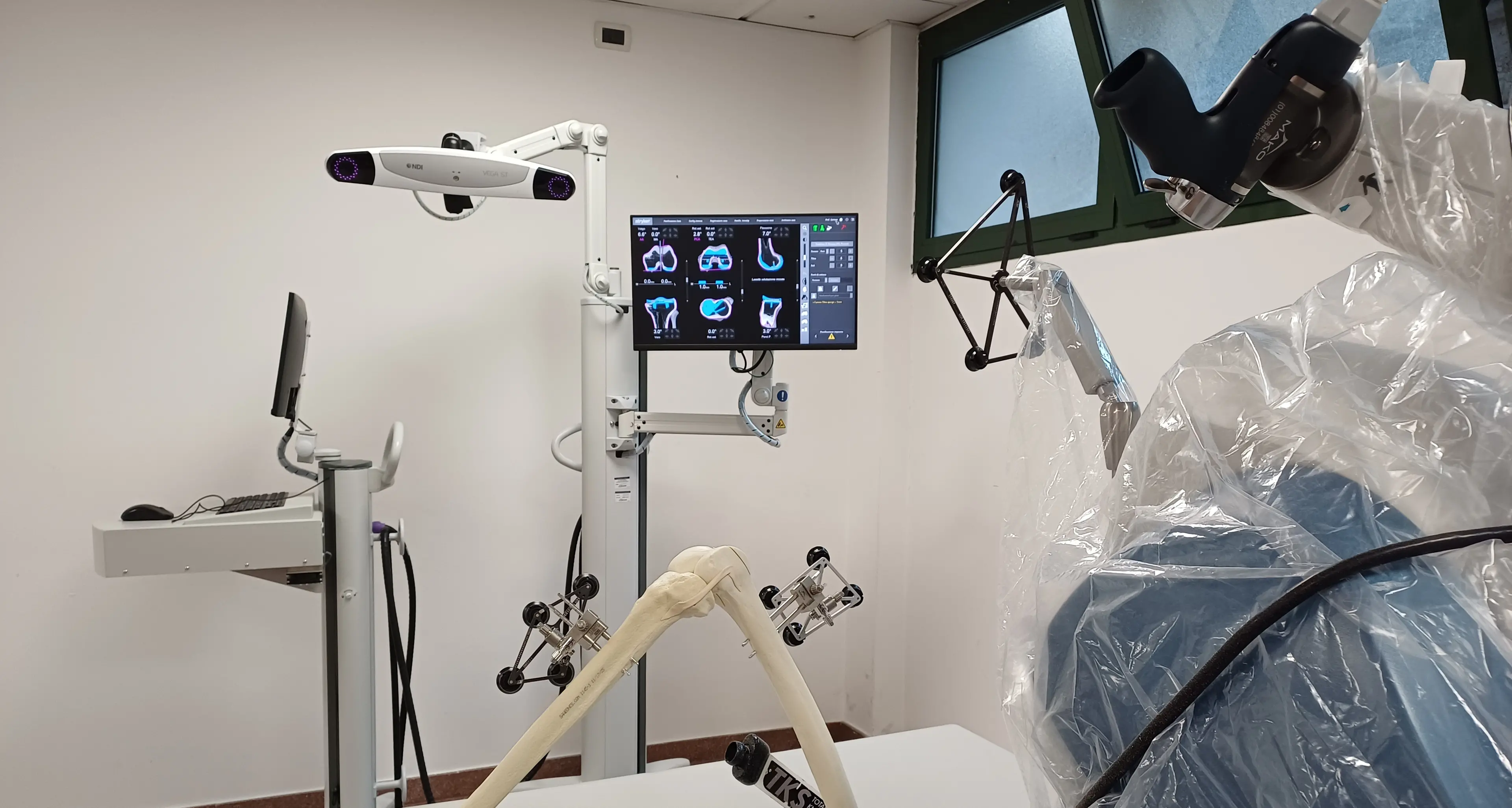 All’ospedale di Arco entra in funzione il robot ortopedico: interventi più precisi e recupero più rapido