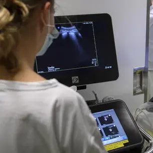 Esami medici, nel 2026 meno prenotazioni e più attese