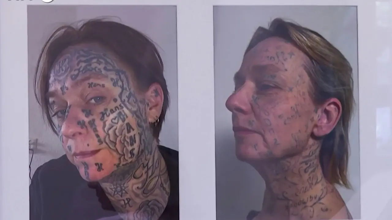 Costrette a tatuarsi dai partner violenti, in Olanda le vittime cancellano i marchi