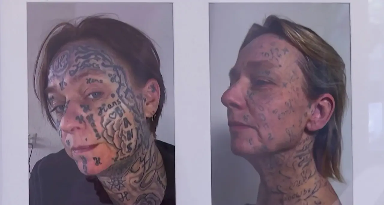 Costrette a tatuarsi dai partner violenti, in Olanda le vittime cancellano i marchi