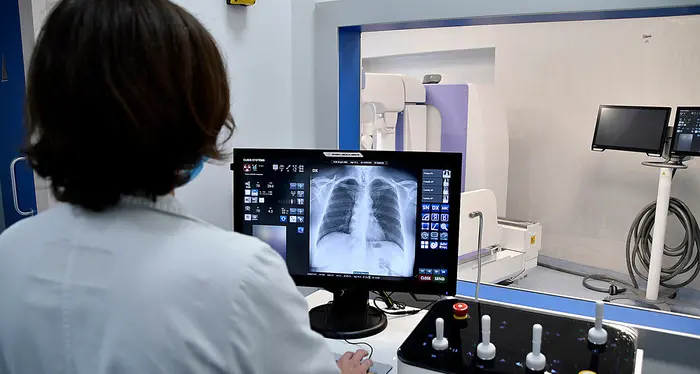Asuit, mancano radiologi: consulenti da Padova pagati 1.500 euro al giorno