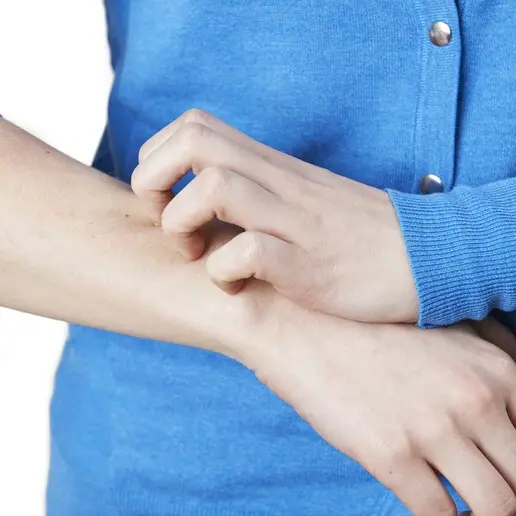 Psoriasi, un integratore a base di vitamina B5 potrebbe alleviare i sintomi