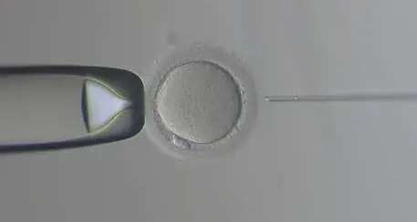 Bologna: dopo il cancro, incinta di due gemelli grazie agli ovociti congelati 14 anni fa