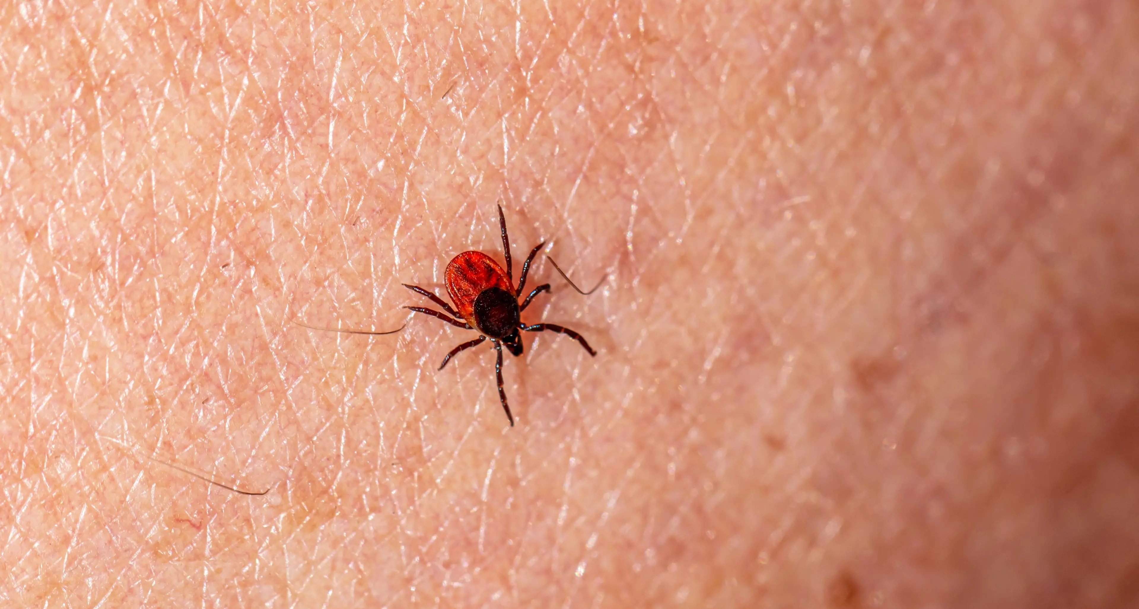 Punture di zecca, in dieci anni aumentati i casi di Tbe e Lyme in Trentino
