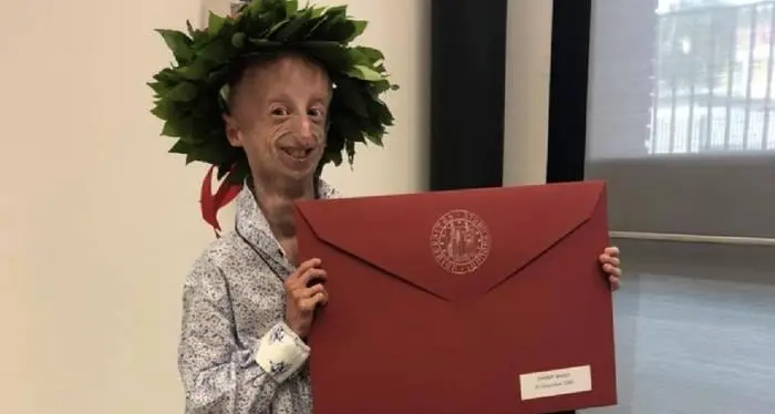 Addio a Sammy Basso, l’Università di Padova: “Persona indimenticabile”