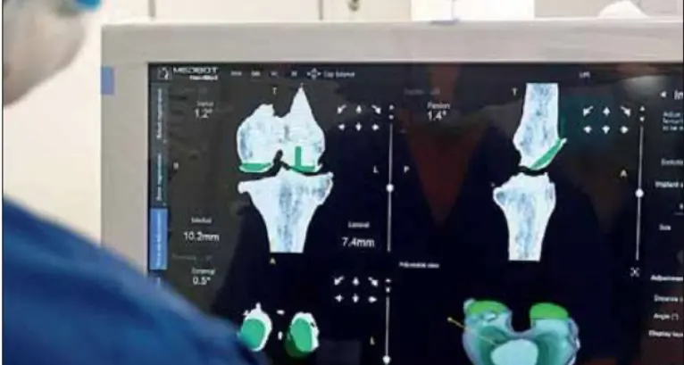 Villa Bianca, protesi al ginocchio col robot. La soddisfazione dei medici: “Sistema innovativo”