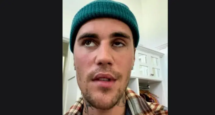 Justin Bieber colpito da paralisi facciale: “Non riesco a cantare”