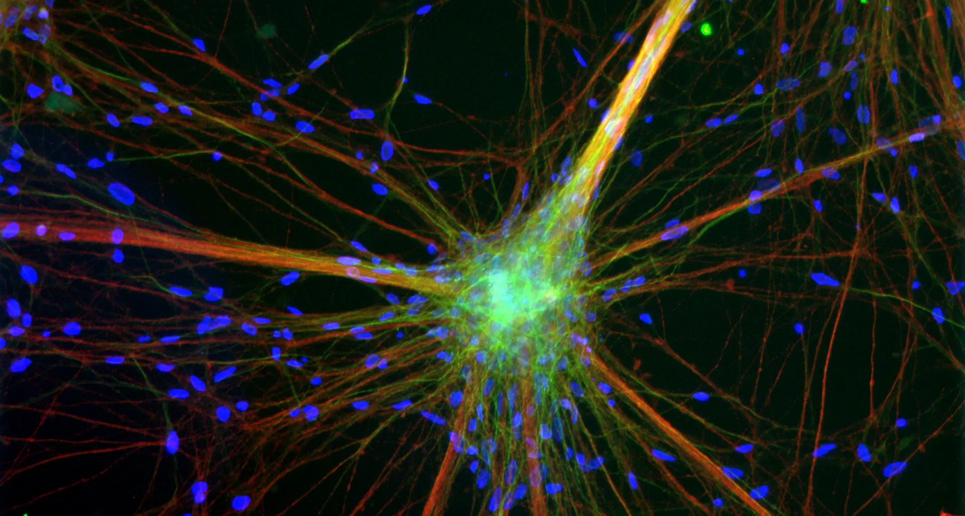 Scoperto l’«interruttore» delle demenze nel cervello, anche il Cibio in prima linea nella ricerca sulla proteina tau