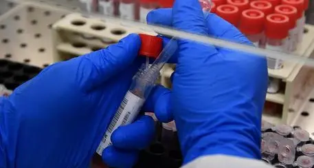 Covid, pochi tamponi fatti ma tanti positivi: in Trentino il tasso va al 13%