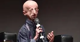 Morto a 28 anni Sammy Basso: aveva fatto conoscere la Progeria