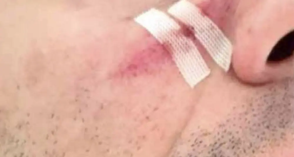 Situazione sempre più tesa nel carcere di Trento: detenuto manda in ospedale 6 agenti