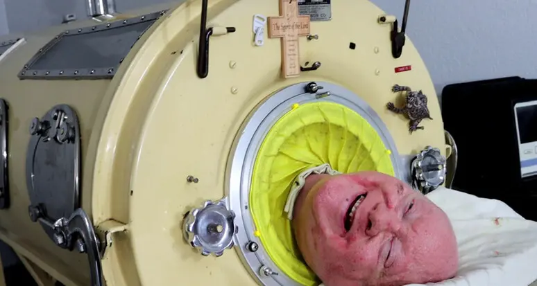 È morto l'uomo che ha vissuto per 70 anni nel polmone d'acciaio
