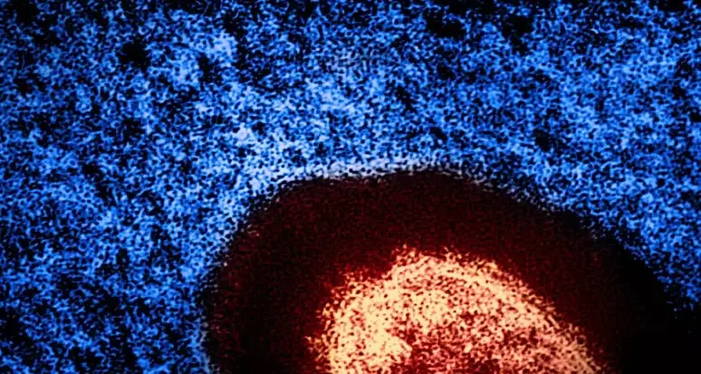 Una virologa trova una terapia, la sperimenta sul suo tumore e guarisce