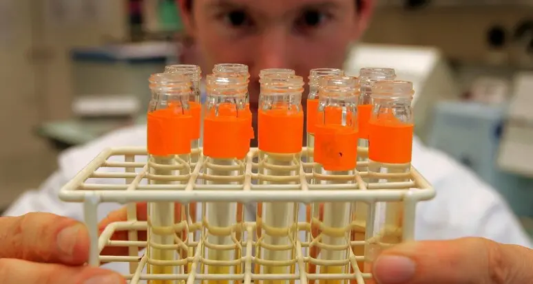 Verso un test delle urine per la diagnosi precoce del cancro alle ovaie