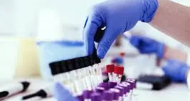 Comune, bocciata la proposta di Demattè: no al test antidroga sui consiglieri