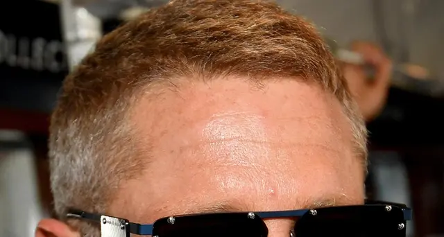 Scritta sul Pantheon, Lapo Elkann: \"città dove tutto è permesso\"