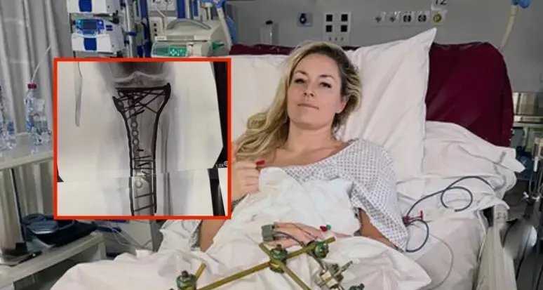 Vonn, sei ore sotto i ferri: “Ora sono bionica per davvero”