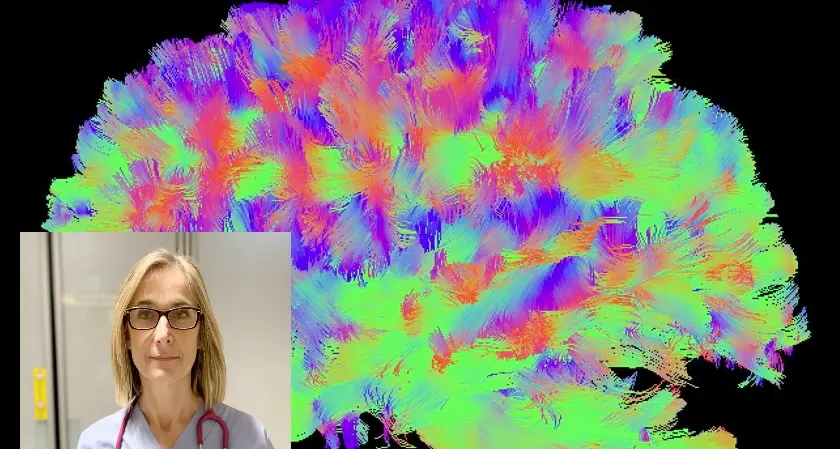 Prevedere le conseguenze del trauma cranico: la scoperta di un nuovo “marker” porta anche la firma di una dottoressa trentina