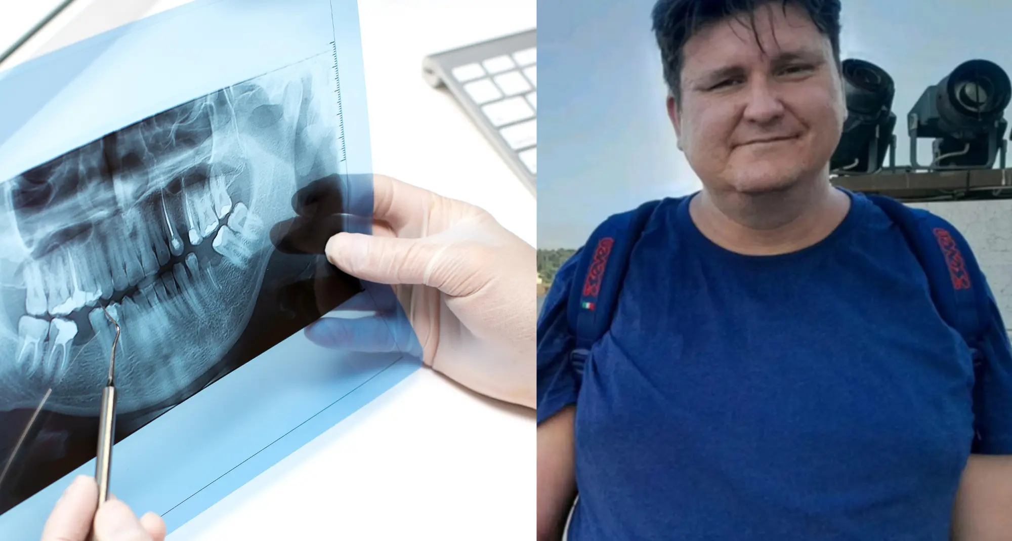 Indagato per omicidio colposo il dentista che ha operato Feretta, deceduto dopo l’intervento