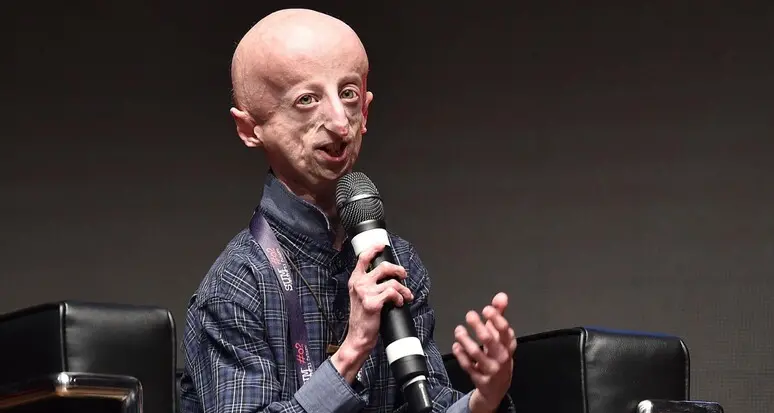 Sammy Basso potrebbe essere beato: «In molti lo chiedono»
