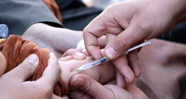 Morbillo:+3.000% casi in Europa e Asia centrale da gennaio