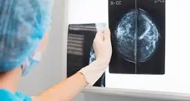 Tumore al seno, 691 casi tra prima diagnosi e recidive nel 2023: sono 150 le donne che hanno meno di 50 anni